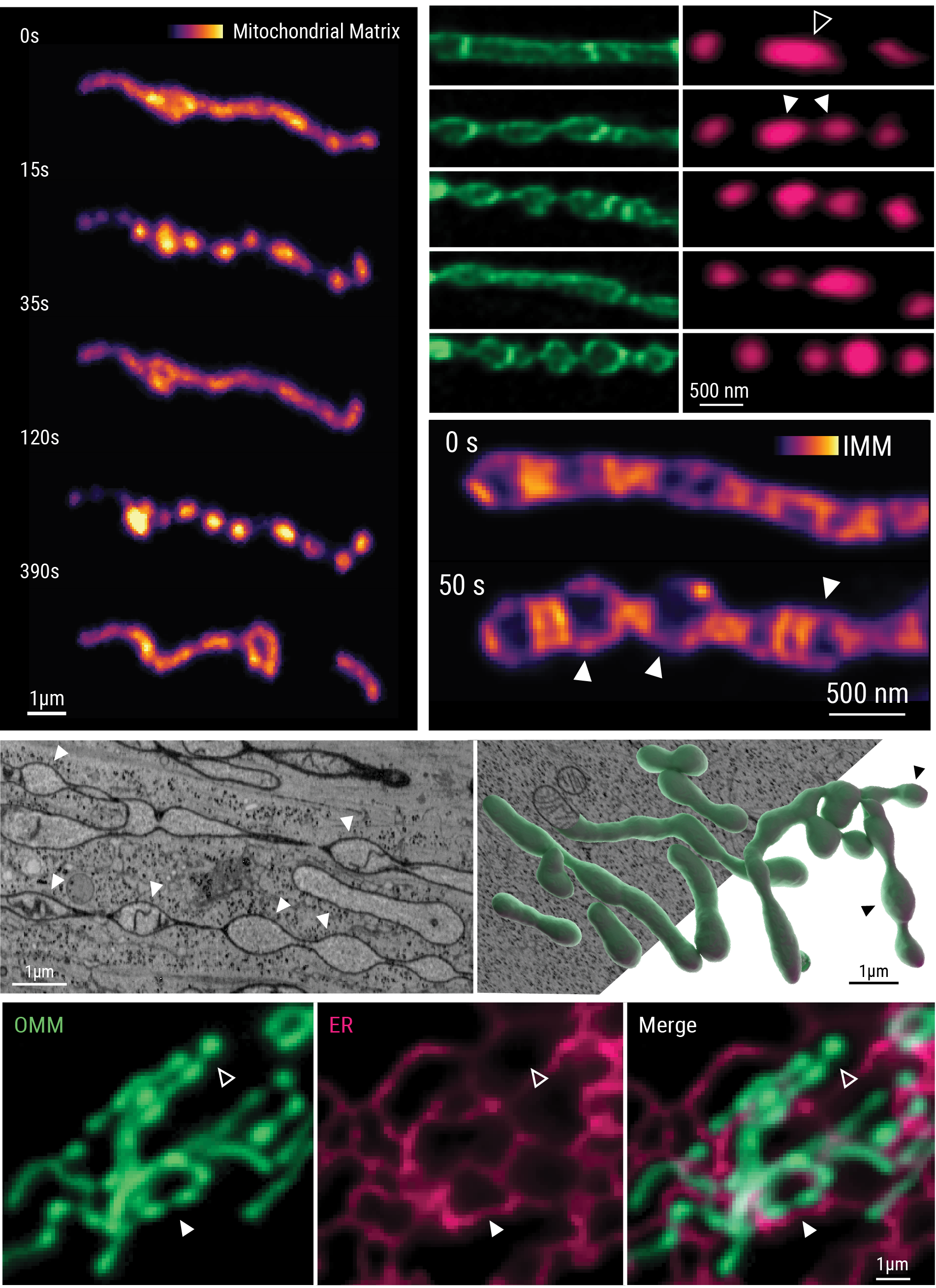 Imaging of mitochondrial pearling dynamics
